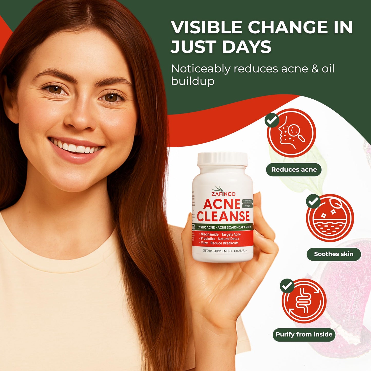 Acne Cleanse Capsules.Powerful Vitex Angus Extract, Niacinamide, Biotin for Teens & Adults. Organic Acne Treatment,Cystic Pimples, Oily Skin to Natural Clear Skin Vitamins Supplement- 60 Count