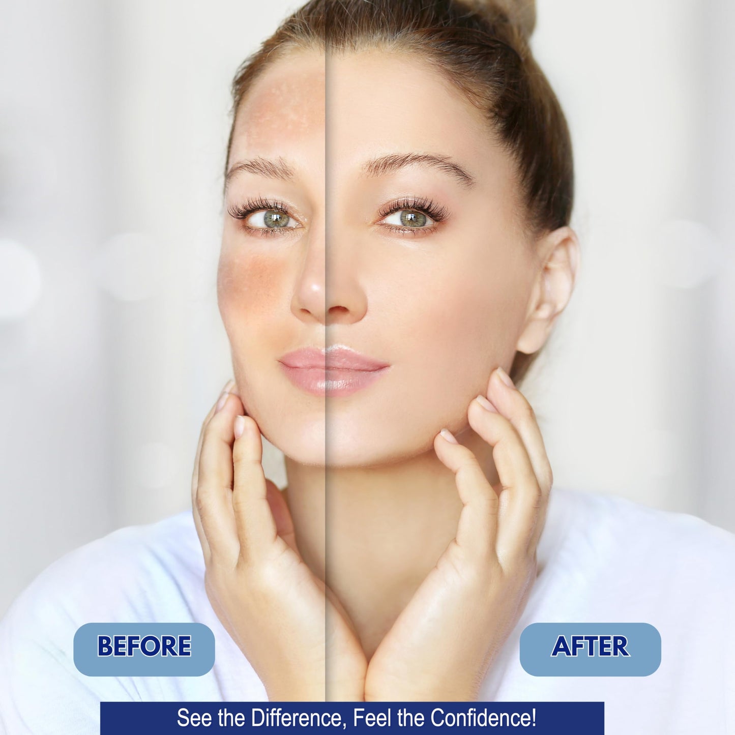 ZAFiNCO Advanced Dark Spot Corrector Cream for Dark Spots, Acne, Age Spots - Dual action Dark Spot Remover for Women and Men with Vitamin C, Salicylic Acid, Suitable for All Skin Types, 0.7 Fl oz